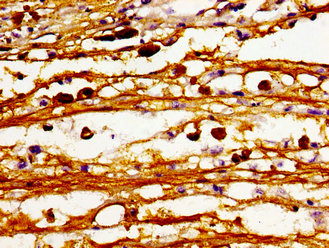 CERS6 Polyclonal Antibody - image 3