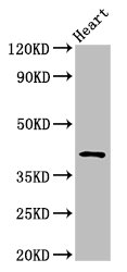 Immunohistochemistry of paraffin-embedded human glioma using CAC15085 at dilution of 1:100