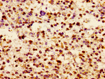 Immunohistochemistry of paraffin-embedded human testis tissue using CAC15085 at dilution of 1:100