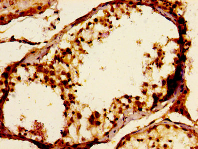 Immunofluorescence staining of Hela cells with CAC15085 at 1:166, counter-stained with DAPI. The cells were fixed in 4% formaldehyde, permeabilized using 0.2% Triton X-100 and blocked in 10% normal Goat Serum. The cells were then incubated with the antibody overnight at 4°C. The secondary antibody was Alexa Fluor 488-congugated AffiniPure Goat Anti-Rabbit IgG(H+L).