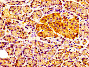 Immunofluorescence staining of Hela cells with CAC15091 at 1:100, counter-stained with DAPI. The cells were fixed in 4% formaldehyde, permeabilized using 0.2% Triton X-100 and blocked in 10% normal Goat Serum. The cells were then incubated with the antibody overnight at 4°C. The secondary antibody was Alexa Fluor 488-congugated AffiniPure Goat Anti-Rabbit IgG(H+L).
