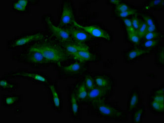CCKAR Polyclonal Antibody - image 4