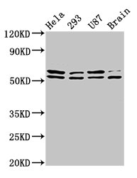 IHC image of CAC15092 diluted at 1:200 and staining in paraffin-embedded human breast cancer performed on a Leica BondTM system. After dewaxing and hydration, antigen retrieval was mediated by high pressure in a citrate buffer (pH 6.0). Section was blocked with 10% normal goat serum 30min at RT. Then primary antibody (1% BSA) was incubated at 4°C overnight. The primary is detected by a biotinylated secondary antibody and visualized using an HRP conjugated SP system.