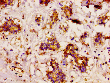 Immunofluorescence staining of Hela cells with CAC15092 at 1:66, counter-stained with DAPI. The cells were fixed in 4% formaldehyde, permeabilized using 0.2% Triton X-100 and blocked in 10% normal Goat Serum. The cells were then incubated with the antibody overnight at 4°C. The secondary antibody was Alexa Fluor 488-congugated AffiniPure Goat Anti-Rabbit IgG(H+L).