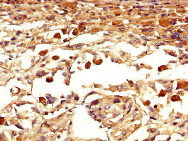 EOMES Polyclonal Antibody - image 4