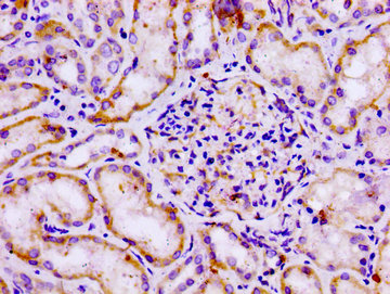 Immunofluorescence staining of Hela cells with CAC15098 at 1:66, counter-stained with DAPI. The cells were fixed in 4% formaldehyde, permeabilized using 0.2% Triton X-100 and blocked in 10% normal Goat Serum. The cells were then incubated with the antibody overnight at 4°C. The secondary antibody was Alexa Fluor 488-congugated AffiniPure Goat Anti-Rabbit IgG(H+L).