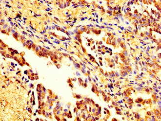 Immunofluorescence staining of HepG2 cells with CAC15103 at 1:66, counter-stained with DAPI. The cells were fixed in 4% formaldehyde, permeabilized using 0.2% Triton X-100 and blocked in 10% normal Goat Serum. The cells were then incubated with the antibody overnight at 4°C. The secondary antibody was Alexa Fluor 488-congugated AffiniPure Goat Anti-Rabbit IgG(H+L).