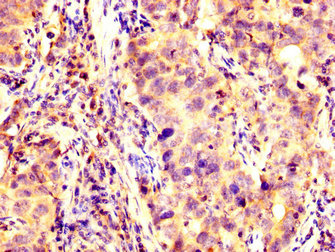 IHC image of CAC15104 diluted at 1:200 and staining in paraffin-embedded human brain tissue performed on a Leica BondTM system. After dewaxing and hydration, antigen retrieval was mediated by high pressure in a citrate buffer (pH 6.0). Section was blocked with 10% normal goat serum 30min at RT. Then primary antibody (1% BSA) was incubated at 4°C overnight. The primary is detected by a biotinylated secondary antibody and visualized using an HRP conjugated SP system.