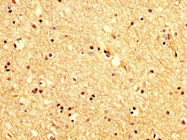 Immunofluorescence staining of HepG2 cells with CAC15104 at 1:66, counter-stained with DAPI. The cells were fixed in 4% formaldehyde, permeabilized using 0.2% Triton X-100 and blocked in 10% normal Goat Serum. The cells were then incubated with the antibody overnight at 4°C. The secondary antibody was Alexa Fluor 488-congugated AffiniPure Goat Anti-Rabbit IgG(H+L).