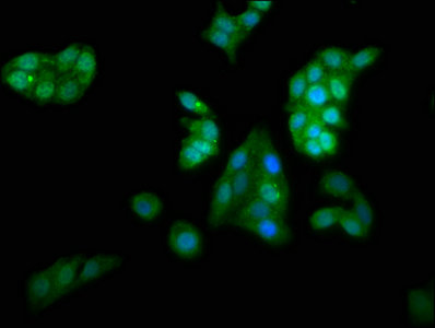 KCNAB1 Polyclonal Antibody - image 5