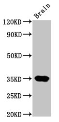 NKX3-2 Polyclonal Antibody - image 2