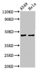 NMBR Polyclonal Antibody - image 2