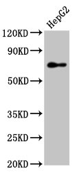 IHC image of CAC15114 diluted at 1:200 and staining in paraffin-embedded human cervical cancer performed on a Leica BondTM system. After dewaxing and hydration, antigen retrieval was mediated by high pressure in a citrate buffer (pH 6.0). Section was blocked with 10% normal goat serum 30min at RT. Then primary antibody (1% BSA) was incubated at 4°C overnight. The primary is detected by a biotinylated secondary antibody and visualized using an HRP conjugated SP system.