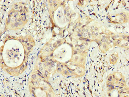 PEX5 Polyclonal Antibody - image 3