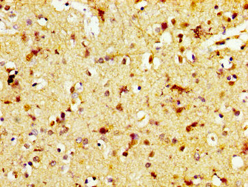 Immunofluorescence staining of Hela cells with CAC15120 at 1:200, counter-stained with DAPI. The cells were fixed in 4% formaldehyde, permeabilized using 0.2% Triton X-100 and blocked in 10% normal Goat Serum. The cells were then incubated with the antibody overnight at 4°C. The secondary antibody was Alexa Fluor 488-congugated AffiniPure Goat Anti-Rabbit IgG(H+L).