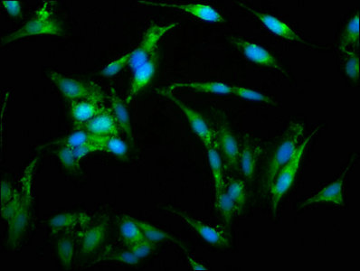 WAS Polyclonal Antibody - image 4