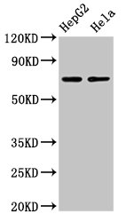 IHC image of CAC15127 diluted at 1:100 and staining in paraffin-embedded human small intestine tissue performed on a Leica BondTM system. After dewaxing and hydration, antigen retrieval was mediated by high pressure in a citrate buffer (pH 6.0). Section was blocked with 10% normal goat serum 30min at RT. Then primary antibody (1% BSA) was incubated at 4°C overnight. The primary is detected by a biotinylated secondary antibody and visualized using an HRP conjugated SP system.