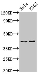 IHC image of CAC15132 diluted at 1:200 and staining in paraffin-embedded human testis tissue performed on a Leica BondTM system. After dewaxing and hydration, antigen retrieval was mediated by high pressure in a citrate buffer (pH 6.0). Section was blocked with 10% normal goat serum 30min at RT. Then primary antibody (1% BSA) was incubated at 4°C overnight. The primary is detected by a biotinylated secondary antibody and visualized using an HRP conjugated SP system.