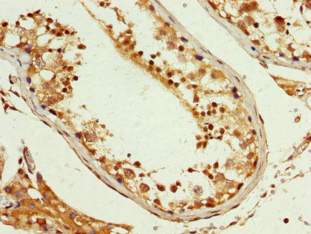 IHC image of CAC15132 diluted at 1:200 and staining in paraffin-embedded human liver tissue performed on a Leica BondTM system. After dewaxing and hydration, antigen retrieval was mediated by high pressure in a citrate buffer (pH 6.0). Section was blocked with 10% normal goat serum 30min at RT. Then primary antibody (1% BSA) was incubated at 4°C overnight. The primary is detected by a biotinylated secondary antibody and visualized using an HRP conjugated SP system.