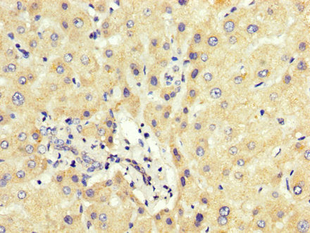 PCBP2 Polyclonal Antibody - image 4
