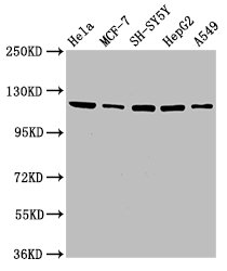 IHC image of CAC15137 diluted at 1:200 and staining in paraffin-embedded human small intestine tissue performed on a Leica BondTM system. After dewaxing and hydration, antigen retrieval was mediated by high pressure in a citrate buffer (pH 6.0). Section was blocked with 10% normal goat serum 30min at RT. Then primary antibody (1% BSA) was incubated at 4°C overnight. The primary is detected by a biotinylated secondary antibody and visualized using an HRP conjugated SP system.