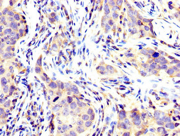 Immunofluorescence staining of Hela cells with CAC15137 at 1:66, counter-stained with DAPI. The cells were fixed in 4% formaldehyde, permeabilized using 0.2% Triton X-100 and blocked in 10% normal Goat Serum. The cells were then incubated with the antibody overnight at 4°C. The secondary antibody was Alexa Fluor 488-congugated AffiniPure Goat Anti-Rabbit IgG(H+L).