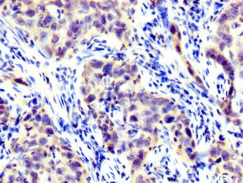LPP Polyclonal Antibody - image 4