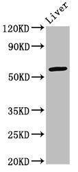 IHC image of CAC15145 diluted at 1:100 and staining in paraffin-embedded human lung cancer performed on a Leica BondTM system. After dewaxing and hydration, antigen retrieval was mediated by high pressure in a citrate buffer (pH 6.0). Section was blocked with 10% normal goat serum 30min at RT. Then primary antibody (1% BSA) was incubated at 4°C overnight. The primary is detected by a biotinylated secondary antibody and visualized using an HRP conjugated SP system.