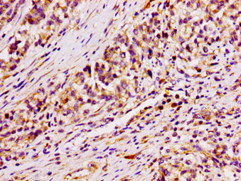 Immunofluorescence staining of HepG2 cells with CAC15145 at 1:100, counter-stained with DAPI. The cells were fixed in 4% formaldehyde, permeabilized using 0.2% Triton X-100 and blocked in 10% normal Goat Serum. The cells were then incubated with the antibody overnight at 4°C. The secondary antibody was Alexa Fluor 488-congugated AffiniPure Goat Anti-Rabbit IgG(H+L).