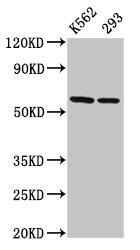 IHC image of CAC15146 diluted at 1:100 and staining in paraffin-embedded human glioma performed on a Leica BondTM system. After dewaxing and hydration, antigen retrieval was mediated by high pressure in a citrate buffer (pH 6.0). Section was blocked with 10% normal goat serum 30min at RT. Then primary antibody (1% BSA) was incubated at 4°C overnight. The primary is detected by a biotinylated secondary antibody and visualized using an HRP conjugated SP system.
