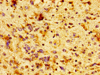 Immunofluorescence staining of MCF-7 cells with CAC15146 at 1:100, counter-stained with DAPI. The cells were fixed in 4% formaldehyde, permeabilized using 0.2% Triton X-100 and blocked in 10% normal Goat Serum. The cells were then incubated with the antibody overnight at 4°C. The secondary antibody was Alexa Fluor 488-congugated AffiniPure Goat Anti-Rabbit IgG(H+L).