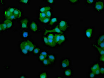 CCT7 Polyclonal Antibody - image 4