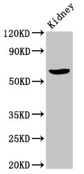IHC image of CAC15148 diluted at 1:500 and staining in paraffin-embedded human appendix tissue performed on a Leica BondTM system. After dewaxing and hydration, antigen retrieval was mediated by high pressure in a citrate buffer (pH 6.0). Section was blocked with 10% normal goat serum 30min at RT. Then primary antibody (1% BSA) was incubated at 4°C overnight. The primary is detected by a biotinylated secondary antibody and visualized using an HRP conjugated SP system.