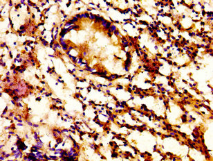 IHC image of CAC15148 diluted at 1:500 and staining in paraffin-embedded human prostate tissue performed on a Leica BondTM system. After dewaxing and hydration, antigen retrieval was mediated by high pressure in a citrate buffer (pH 6.0). Section was blocked with 10% normal goat serum 30min at RT. Then primary antibody (1% BSA) was incubated at 4°C overnight. The primary is detected by a biotinylated secondary antibody and visualized using an HRP conjugated ABC system.