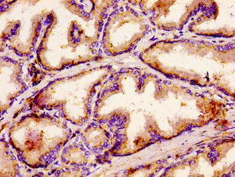 Immunofluorescence staining of Hela cells with CAC15148 at 1:166, counter-stained with DAPI. The cells were fixed in 4% formaldehyde, permeabilized using 0.2% Triton X-100 and blocked in 10% normal Goat Serum. The cells were then incubated with the antibody overnight at 4°C. The secondary antibody was Alexa Fluor 488-congugated AffiniPure Goat Anti-Rabbit IgG(H+L).
