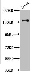 Western Blot, Positive WB detected in: Hela whole cell lysate, A549 whole cell lysate, 293T whole cell lysate, All lanes: MAN2B2 antibody at 1.4ug/ml, Secondary, Goat polyclonal to rabbit IgG at 1/50000 dilution, Predicted band size: 114, 108 kDa, Observed band size: 135 kDa
