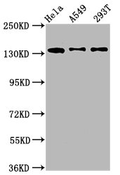 IHC image of CAC15154 diluted at 1:100 and staining in paraffin-embedded human thyroid tissue performed on a Leica BondTM system. After dewaxing and hydration, antigen retrieval was mediated by high pressure in a citrate buffer (pH 6.0). Section was blocked with 10% normal goat serum 30min at RT. Then primary antibody (1% BSA) was incubated at 4°C overnight. The primary is detected by a biotinylated secondary antibody and visualized using an HRP conjugated SP system.