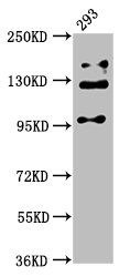 IHC image of CAC15163 diluted at 1:300 and staining in paraffin-embedded human testis tissue performed on a Leica BondTM system. After dewaxing and hydration, antigen retrieval was mediated by high pressure in a citrate buffer (pH 6.0). Section was blocked with 10% normal goat serum 30min at RT. Then primary antibody (1% BSA) was incubated at 4°C overnight. The primary is detected by a biotinylated secondary antibody and visualized using an HRP conjugated SP system.