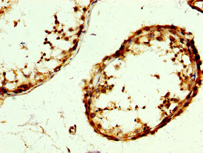 IHC image of CAC15163 diluted at 1:300 and staining in paraffin-embedded human small intestine tissue performed on a Leica BondTM system. After dewaxing and hydration, antigen retrieval was mediated by high pressure in a citrate buffer (pH 6.0). Section was blocked with 10% normal goat serum 30min at RT. Then primary antibody (1% BSA) was incubated at 4°C overnight. The primary is detected by a biotinylated secondary antibody and visualized using an HRP conjugated SP system.