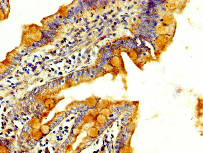 RAB3GAP2 Polyclonal Antibody - image 4