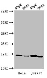 Immunocytochemistry analysis of Hela cells using CAC15180 at dilution of 1:100