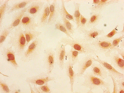 Immunofluorescent analysis of Hela cells using CAC15180 at dilution of 1:100 and Alexa Fluor 488-congugated AffiniPure Goat Anti-Rabbit IgG(H+L)