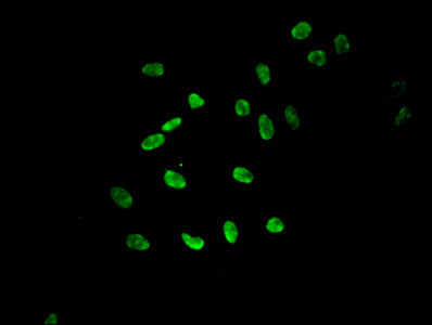 Mono-methyl-HIST1H3A (K9) Polyclonal Antibody - image 4