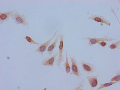 Immunofluorescent analysis of Hela cells using CAC15220 at dilution of 1:100 and Alexa Fluor 488-congugated AffiniPure Goat Anti-Rabbit IgG(H+L)