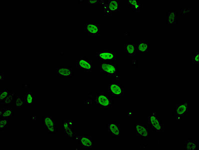 Acetyl-HIST1H2BB (K5) Polyclonal Antibody - image 3