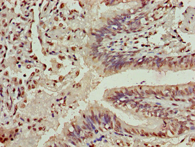 Immunofluorescent analysis of Hela cells using CAC15225 at dilution of 1:100 and Alexa Fluor 488-congugated AffiniPure Goat Anti-Rabbit IgG(H+L)
