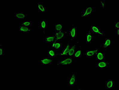 Immunoprecipitating HIST1H3A in Hela whole cell lysate, Lane 1: Rabbit control IgG instead of CAC15225 in Hela whole cell lysate. For western blotting, a HRP-conjugated Protein G antibody was used as the secondary antibody (1/2000), Lane 2: CAC15225 (5ug) + Hela whole cell lysate (500ug), Lane 3: Hela whole cell lysate (20ug)