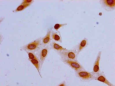 Immunofluorescent analysis of Hela cells (sodium butyrate, 30 mM, 4h) using CAC15237 at dilution of 1:100 and Alexa Fluor 488-congugated AffiniPure Goat Anti-Rabbit IgG(H+L)