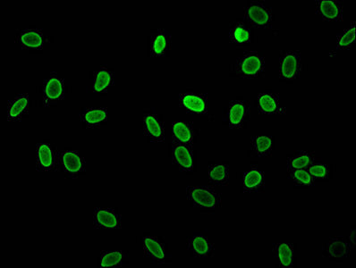 Chromatin Immunoprecipitation Hela (4*10 6 , treated with 30mM sodium butyrate for 4h) were treated with Micrococcal Nuclease, sonicated, and immunoprecipitated with 8ug anti-HIST1H1C (CAC15237) or a control normal rabbit IgG. The resulting ChIP DNA was quantified using real-time PCR with primers against the β-Globin promoter.