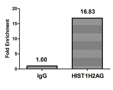 Immunocytochemistry analysis of CAC15271 diluted at 1:50 and staining in Hela cells (treated with 30mM sodium crotonylate for 4h) performed on a Leica BondTM system. The cells were fixed in 4% formaldehyde, permeabilized using 0.2% Triton X-100 and blocked with 10% normal goat serum 30min at RT. Then primary antibody (1% BSA) was incubated at 4°C overnight. The primary is detected by a biotinylated secondary antibody and visualized using an HRP conjugated SP system.
